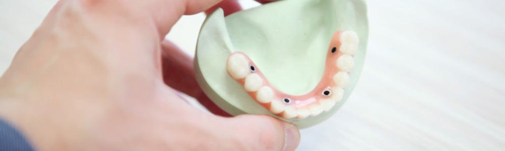 Zinc-Oxide-Eugenol-in-Dentistry-Detail - PT Citra CakraLogam